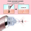Vacuum Facial Exfoliator - Clean Your Face From Blackheads & Acne!